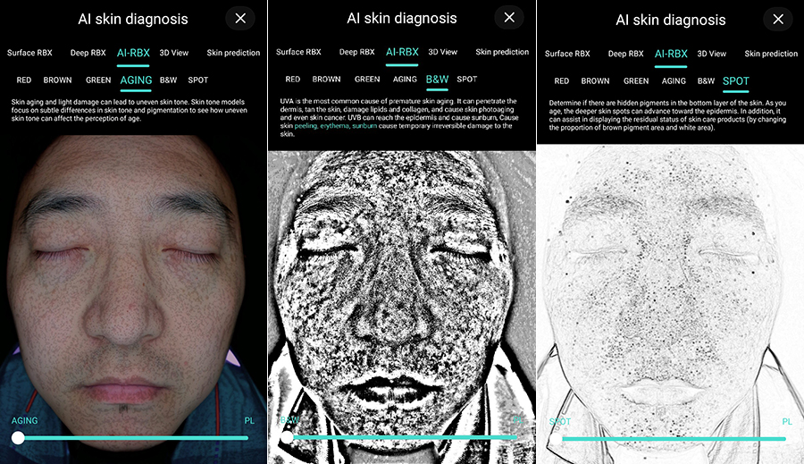 Why More and More Aesthetic Centers Are Using Skin Analyzer?
