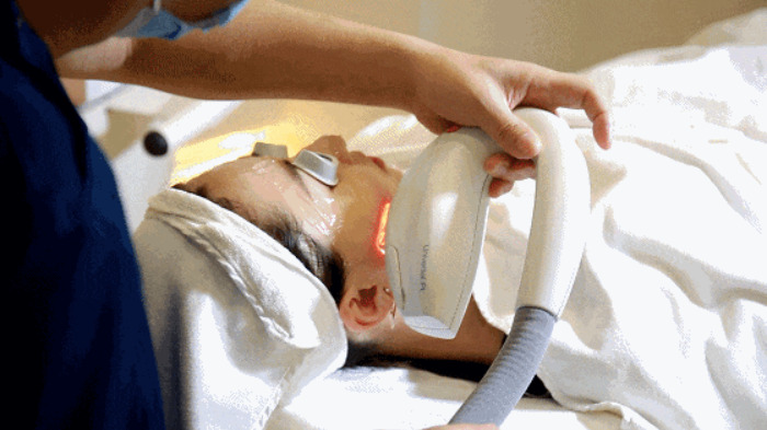Is It Enough To Do Intense Pulsed Light Skin Rejuvenation For Only Ten Minutes?