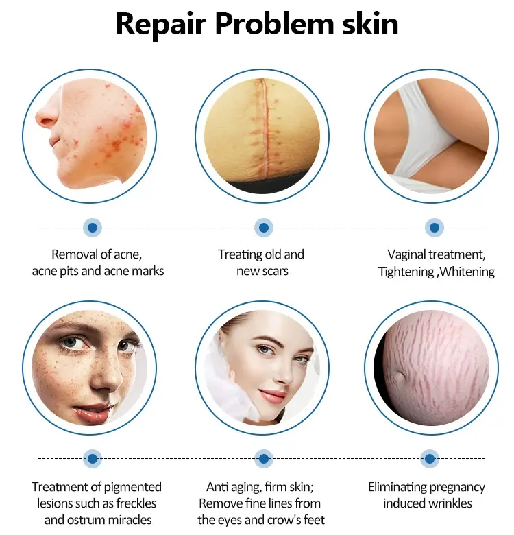 Co2 Laser Machine for Skin